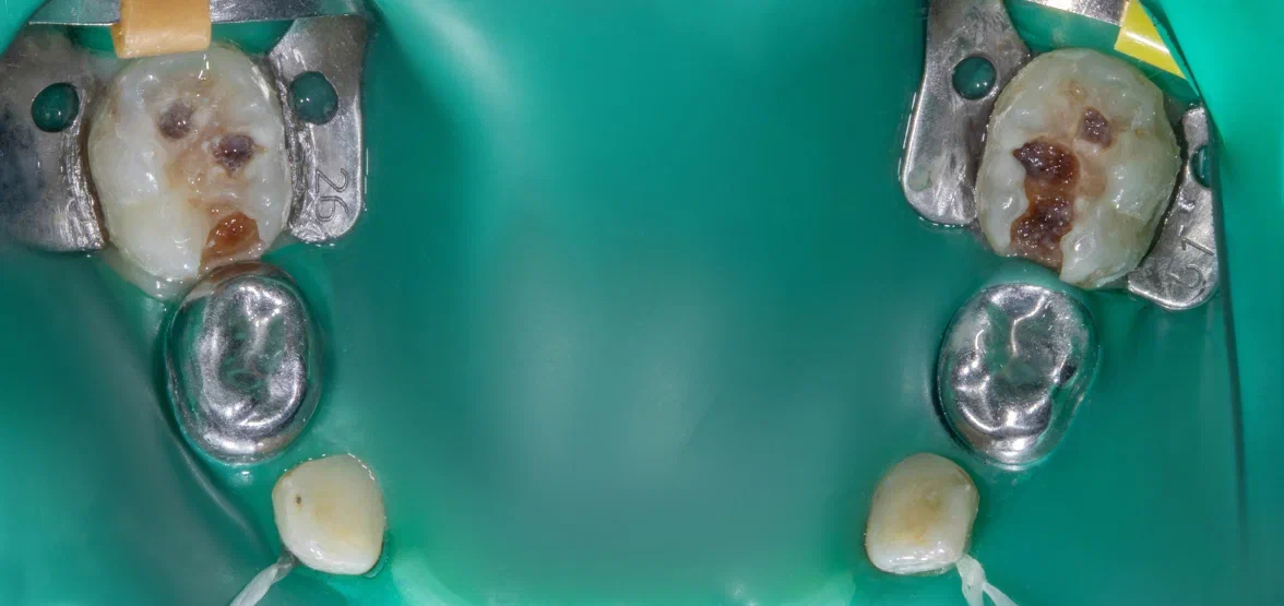 До